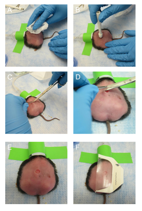 Figure 4