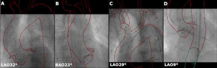 Figure 4