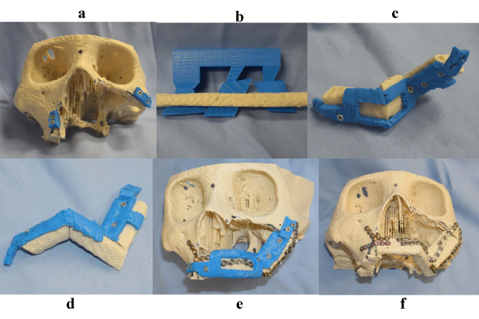 Figure 9