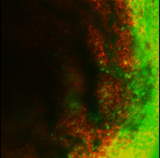 Real Time In Vivo Tracking of Thymocytes in the Anterior Chamber of the ...