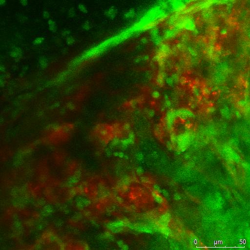 Real Time In Vivo Tracking of Thymocytes in the Anterior Chamber of the ...