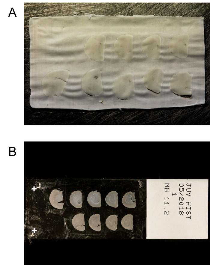 Figure 5