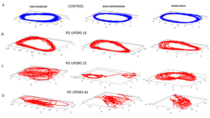 Figure 11