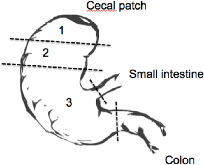 Chronic Salmonella Infection Induced Intestinal Fibrosis - JoVE