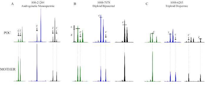 Figure 11