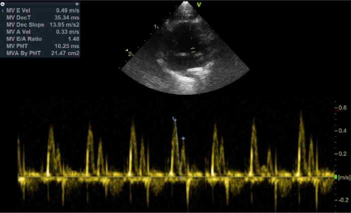 Figure 10