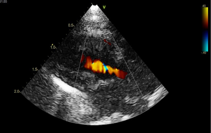 Figure 13