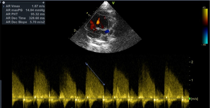 Figure 14