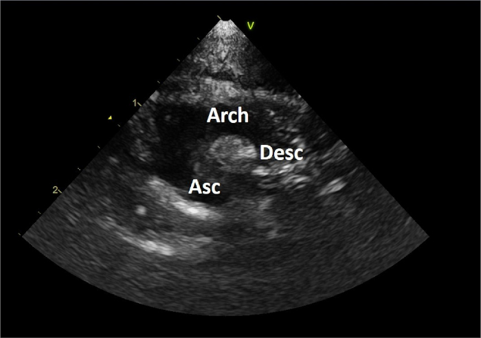 Figure 15