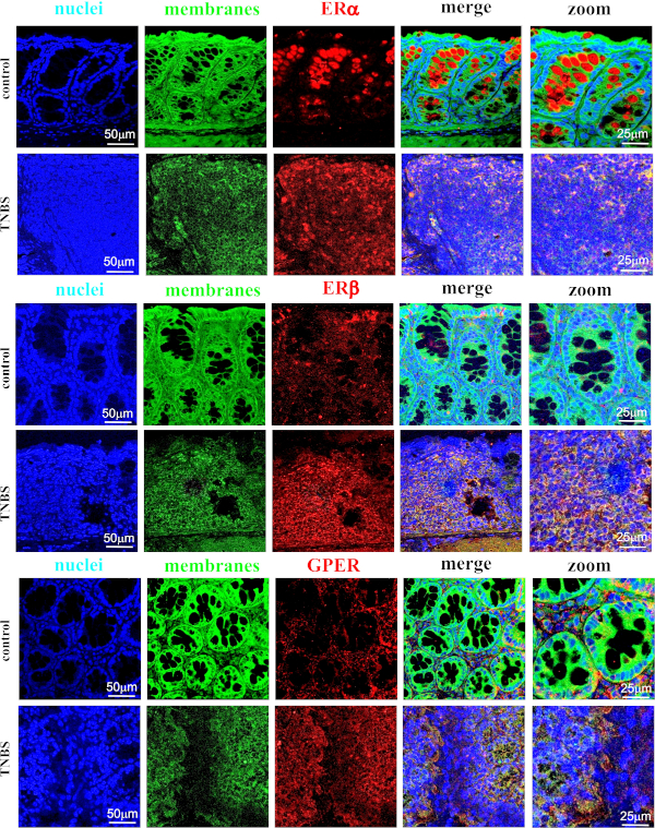 Visualization of Estrogen Receptors in Colons of Mice with TNBS-Induced ...