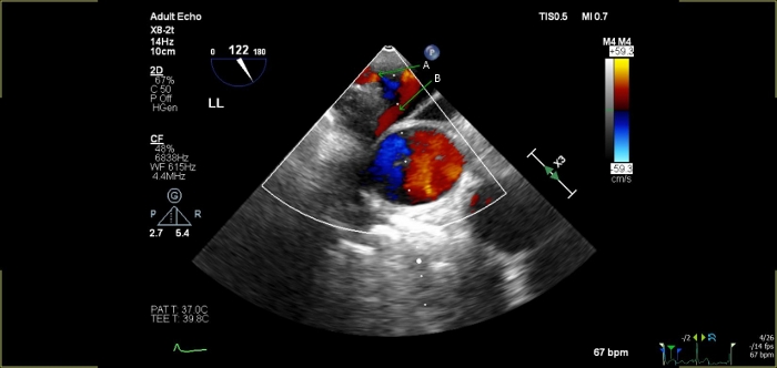 Figure 5