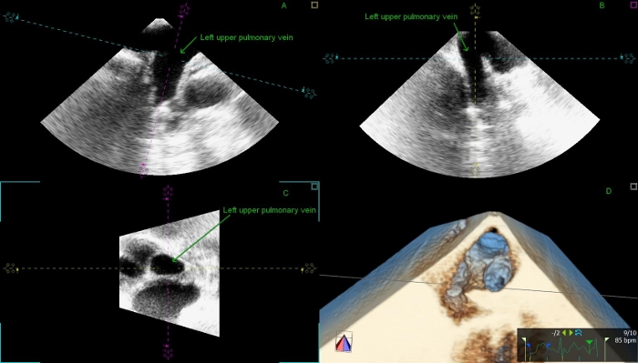 Figure 11