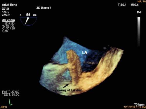 Figure 5