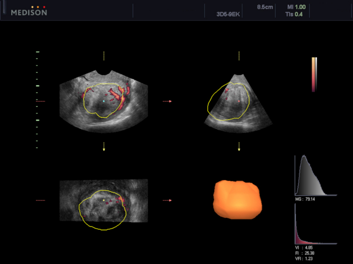 Figure 6