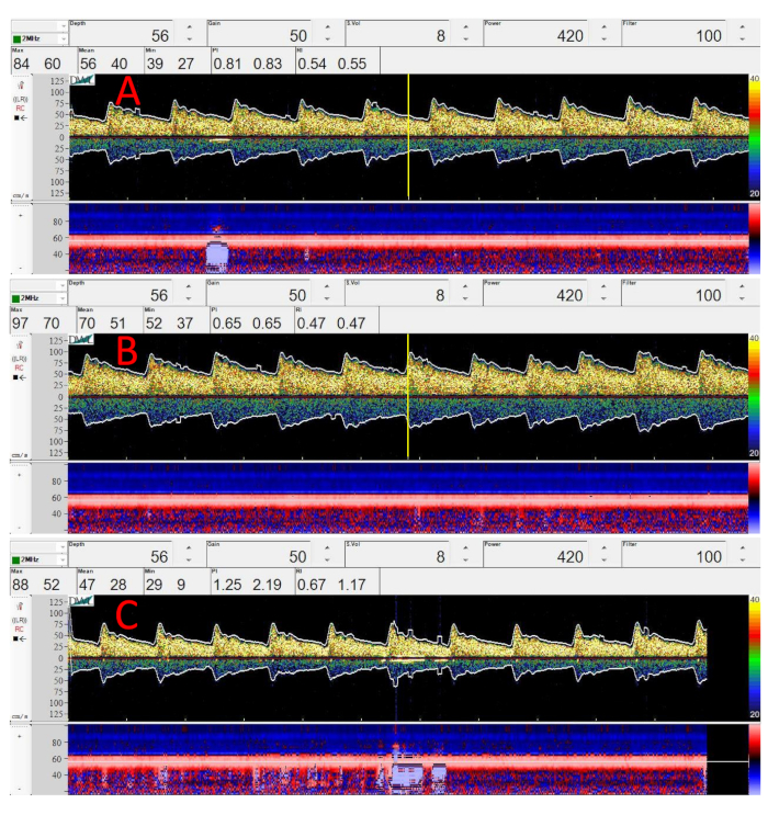 Figure 6