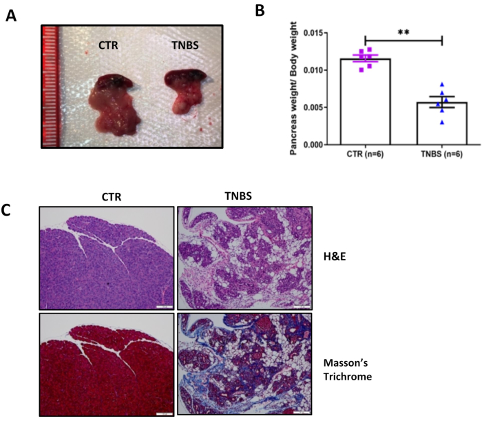 A Mouse Model for Chronic Pancreatitis via Bile Duct TNBS Infusion - JoVE