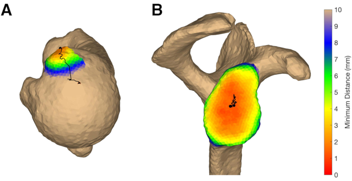 Figure 11