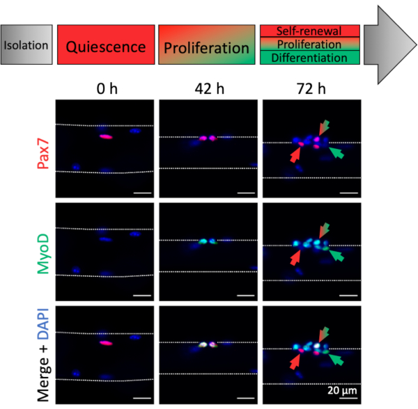 Single Myofiber Culture Assay For The Assessment Of Adult Muscle Stem ...