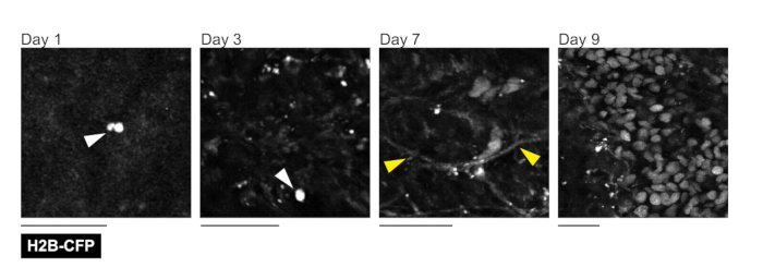 Figure 11