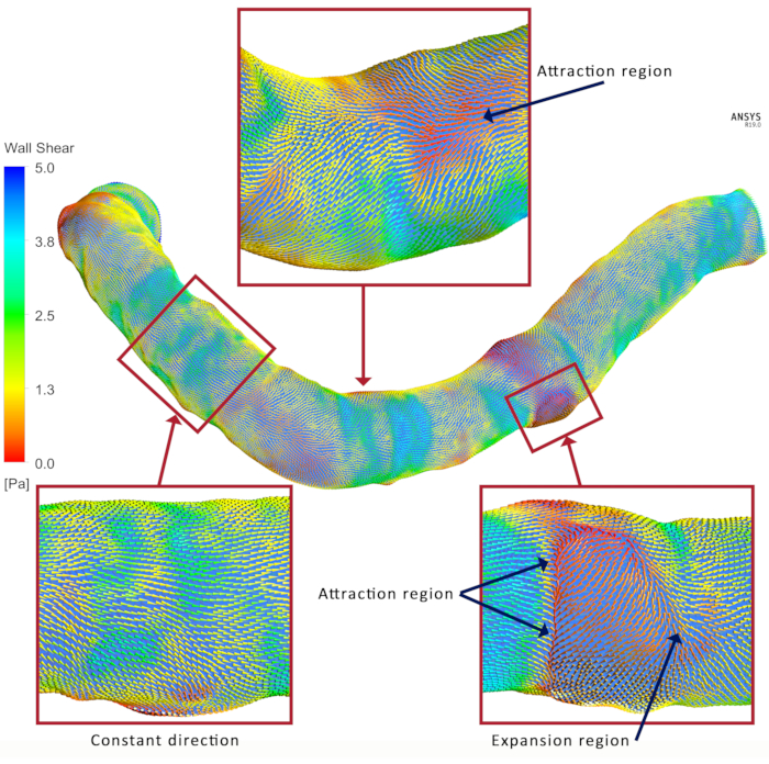 Figure 11