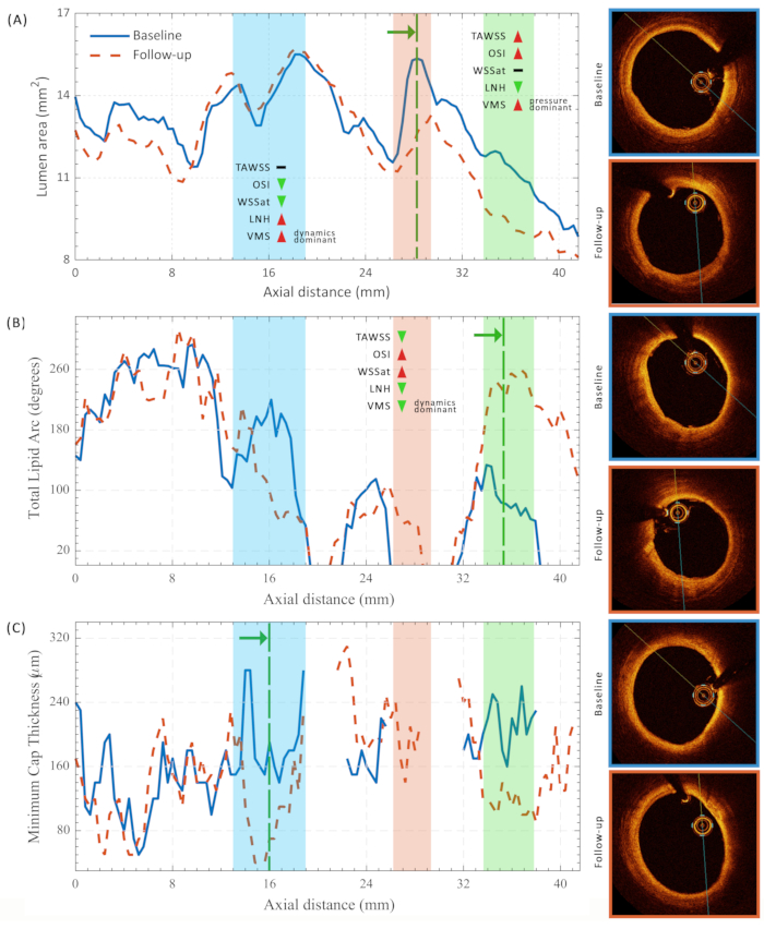 Figure 14