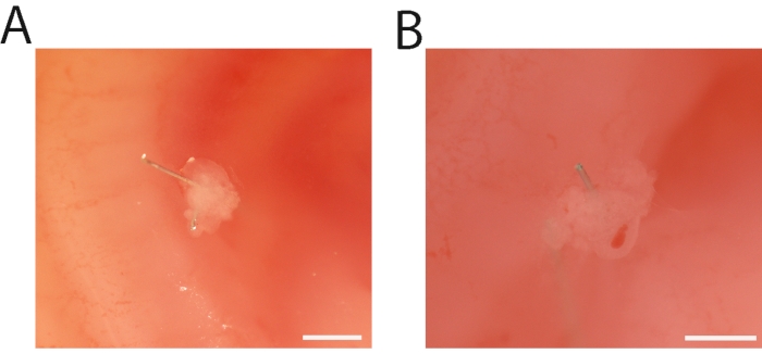 Chicken Recombinant Limbs Assay to Understand Morphogenesis, Patterning ...