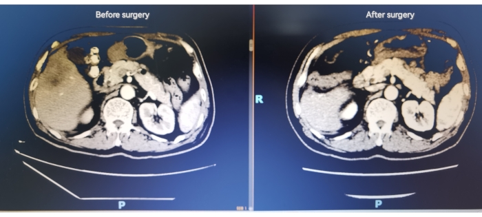 Figure 13