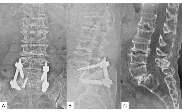 Figure 14