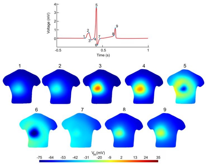 Figure 14