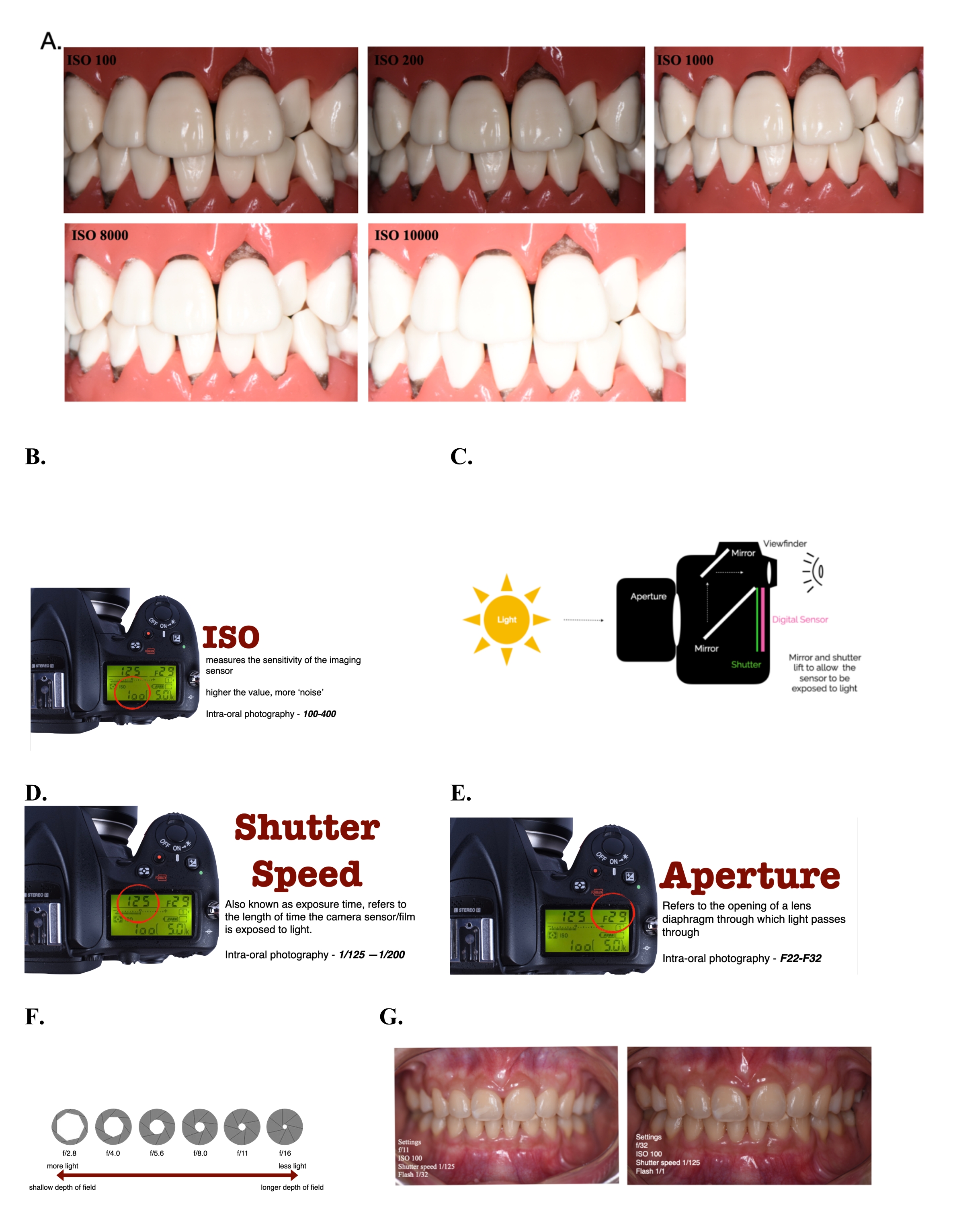 Comment Intégrer la Photographie Dentaire dans son Exercice?