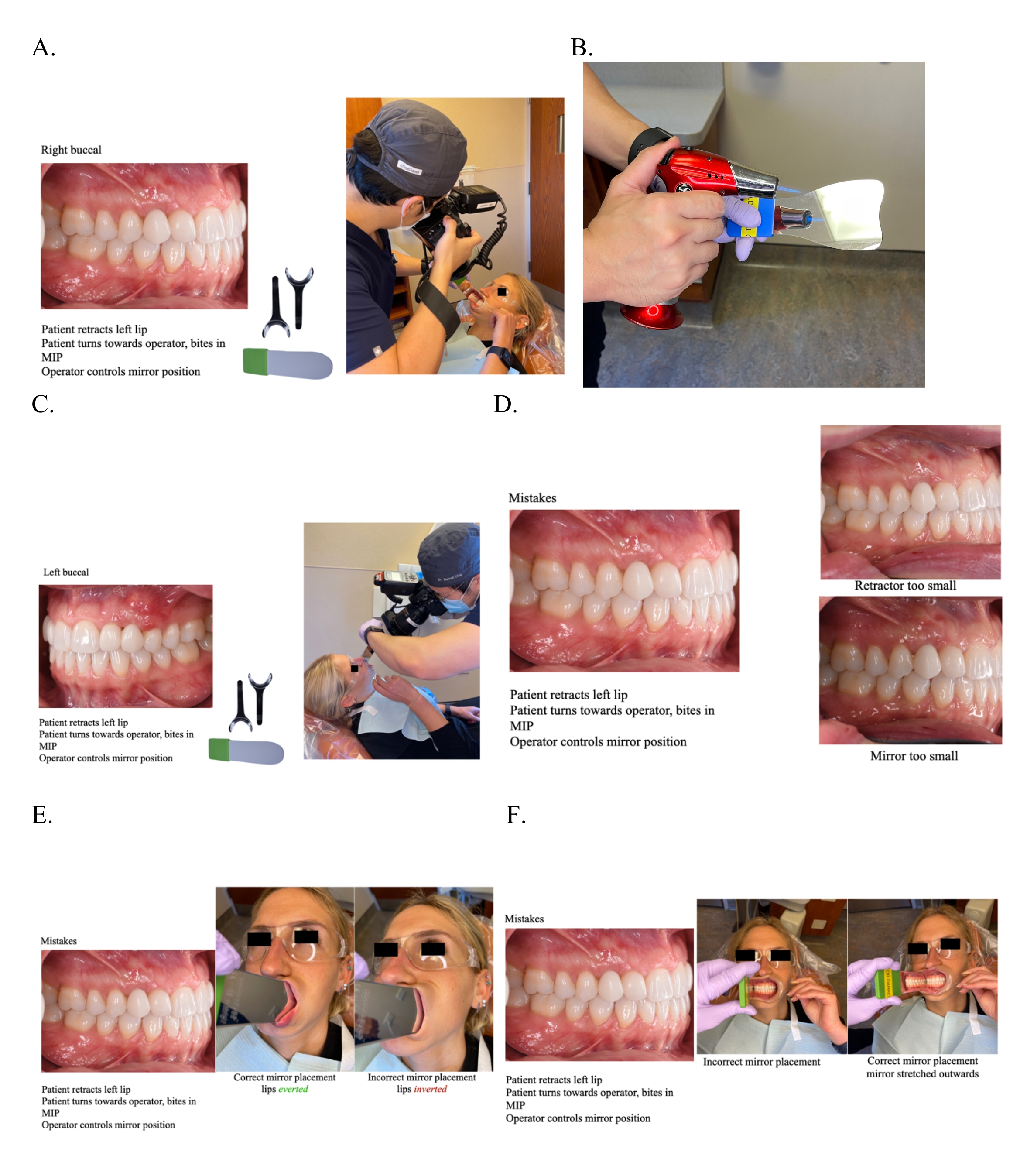 Le rôle de l'assistant(e) dentaire dans la photographie – L