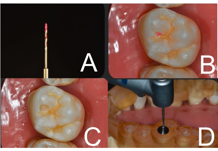 Figure 6