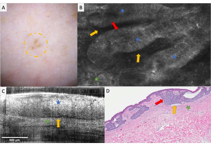 Figure 11