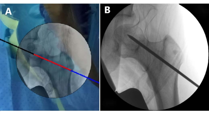 Figure 9