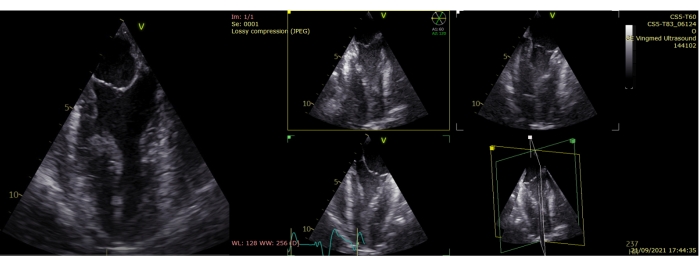 Figure 6