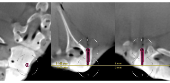 Figure 9