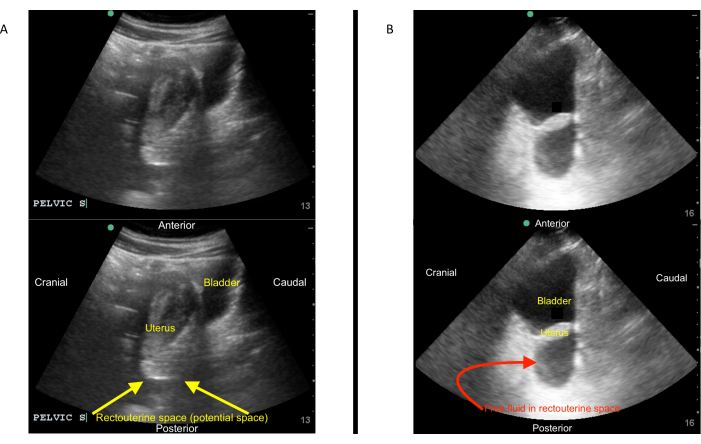 Figure 13