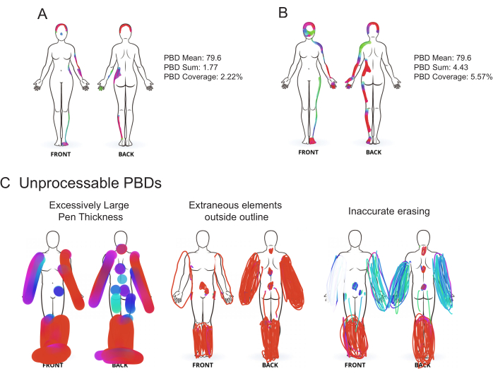 Quantifying Pain Location and Intensity with Multimodal Pain Body ...