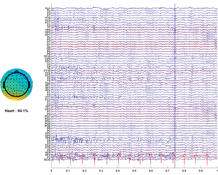 Figure 17