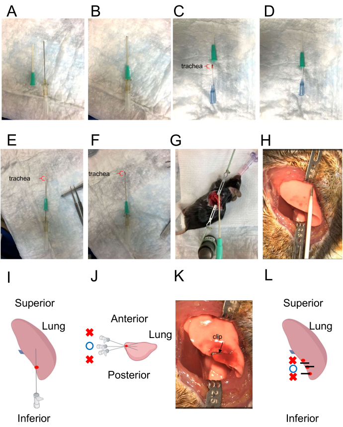 Murine Intrapulmonary Tracheal Transplantation: A Model for ...