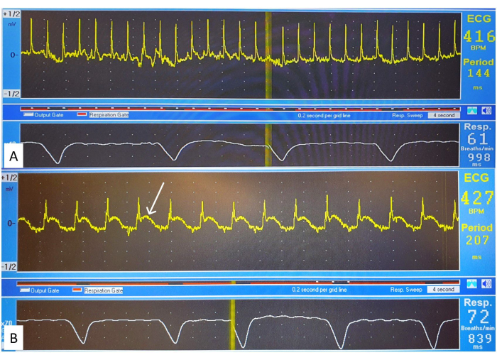 Figure 12