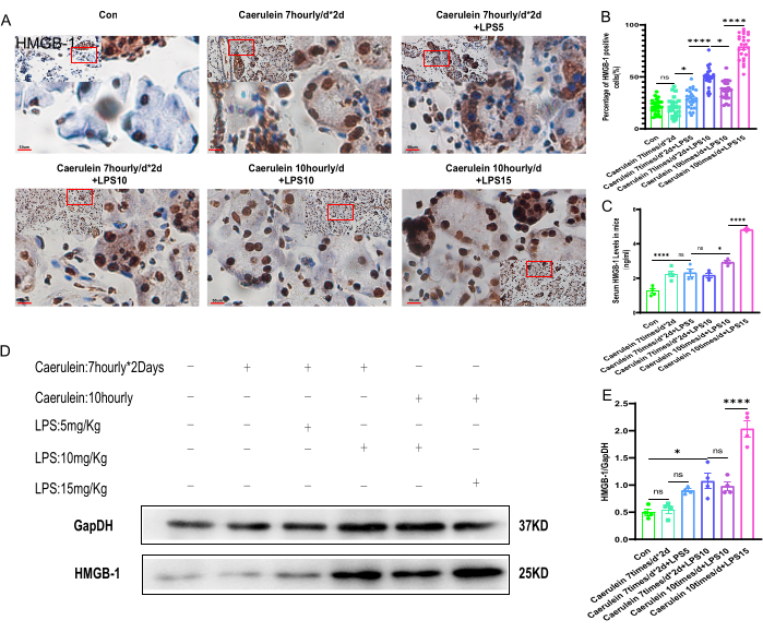 Preparing a Mice Model of Severe Acute Pancreatitis via a Combination ...