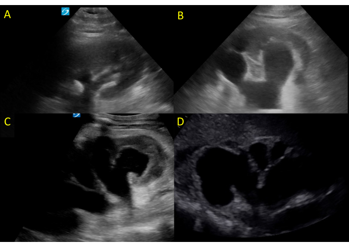 Figure 12