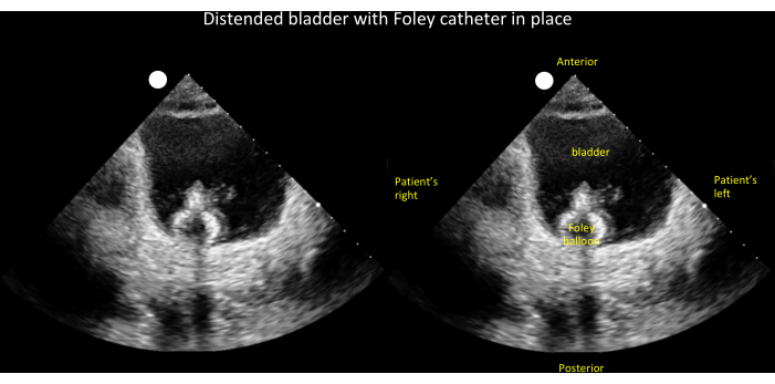 Figure 18