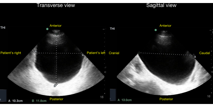 Figure 20