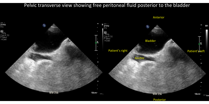 Figure 21