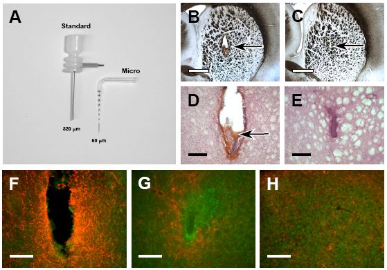 Localized trauma caused by a microcannula compared to a standard delivery cannula after 5 days of saline infusion. (A) A microcannula pulled from borosilicate tubing with a tip diameter of 50 .m allows free, unrestricted flow of most neuroactive agents, yet is 6X smaller than a standard delivery cannula (28 ga, 0.30 mm). (B, C) Unstained, wet mounts of coronal sections (thickness, 70 .m) illustrating greater local tissue damage (arrows) caused by a standard cannula (B) when compared to a microcannula (C). (D, E) Higher power photomicrographs of H&E stained sections shown in B and C, respectively. The standard cannula caused more extensive traumatic injury as illustrated in D, having displaced a larger area of tissue and causing greater insult to the vasculature as demonstrated by the collection of blood within the lesion cavity (arrow). The lesion caused by the microcannula, however, is considerably smaller and less disruptive to tissue at the site of infusion. (F, G, H) Immunofluorescence against GFAP demonstrates dramatically increased numbers of GFAP+ astrocytes around the lesion of the standard cannula (F) when compared to that of the microcannula (G) and normal, unlesioned striatum (H). Scale bars: A & B, 1 mm; D - H, 250 .m.